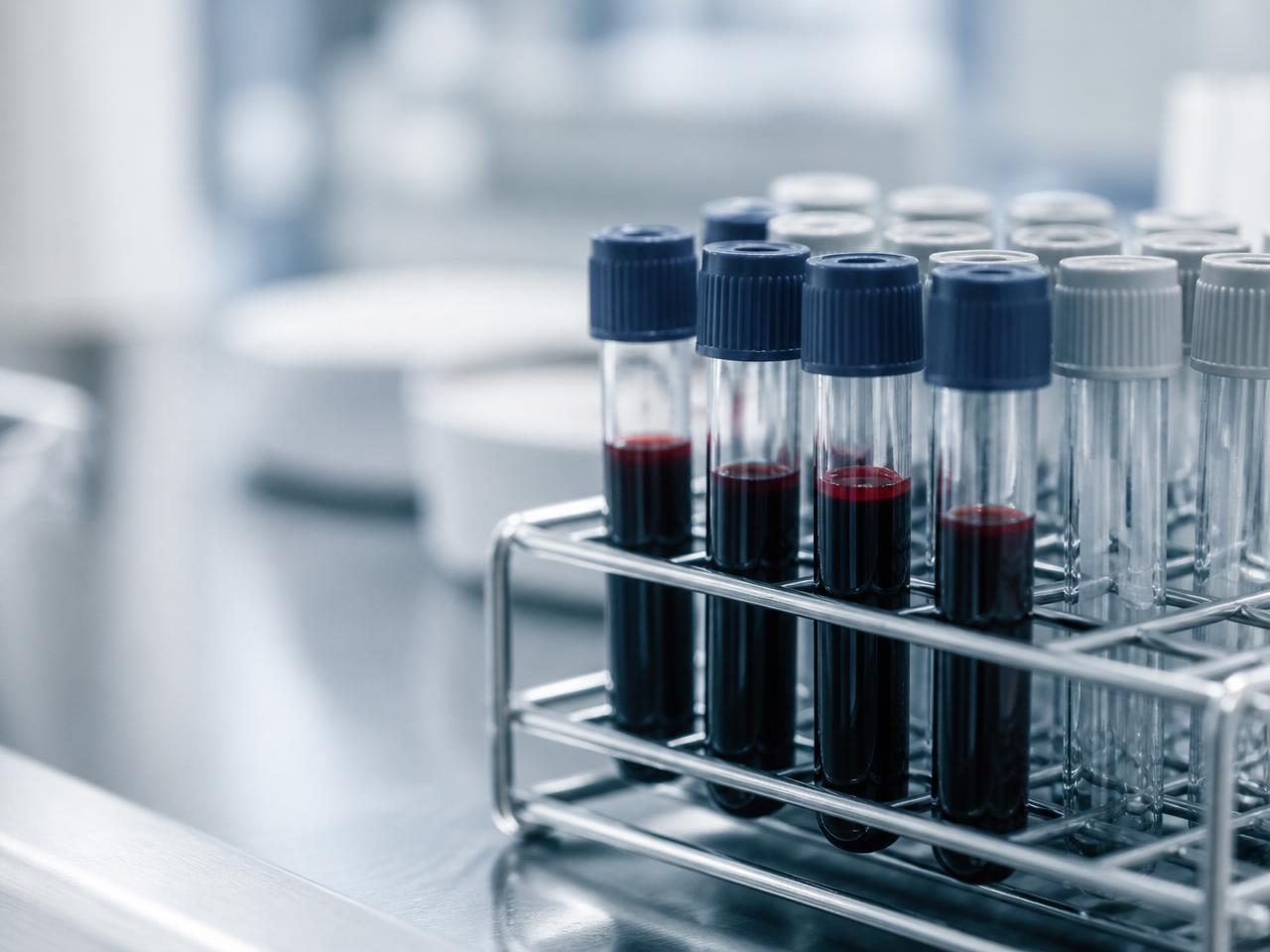 Blood sample vials in a rack on a stainless laboratory counter